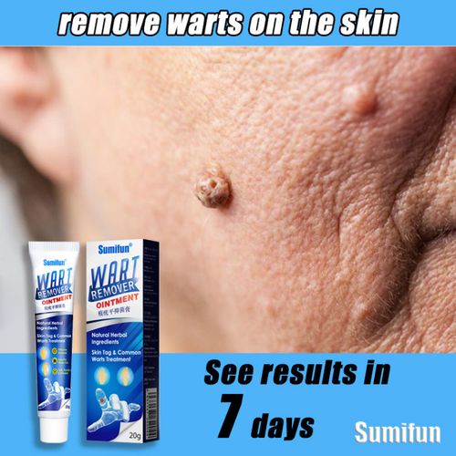Wart Removal Ointment Plus【product fidelity!】