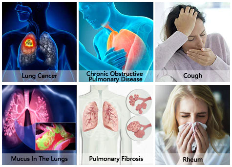 AAFQ™ Cordyceps sinensis Extract – Lung Cleansing Drops – Clean and Breathe