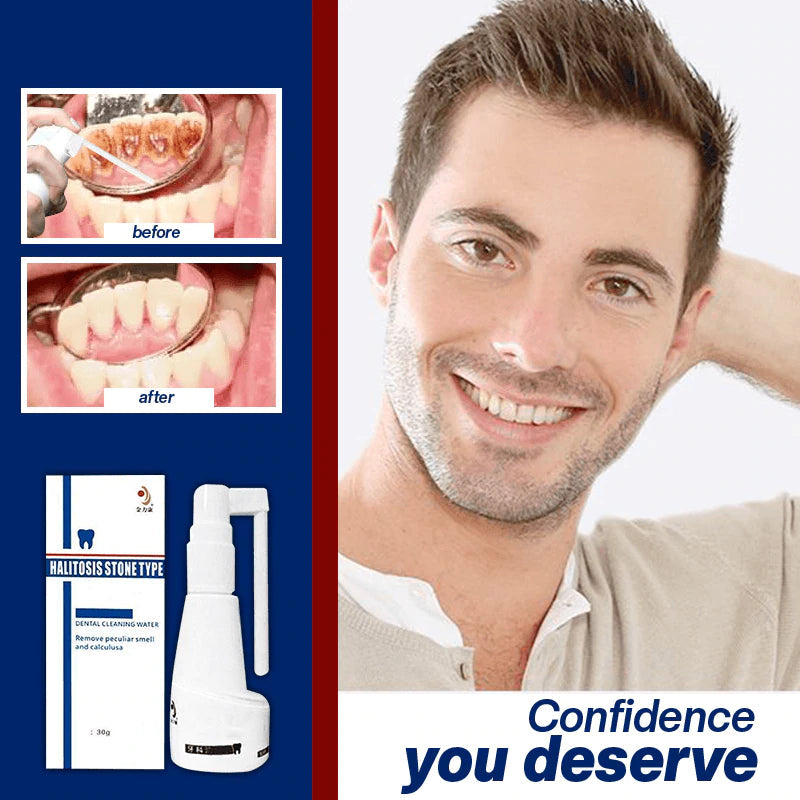 Calculus Free Dissolving Dental Spray【COD + Local Stock !】