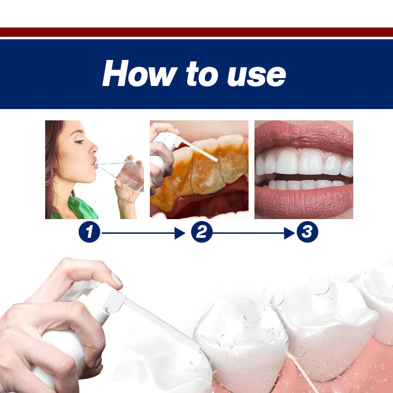 Calculus Free Dissolving Dental Spray【COD + Local Stock !】