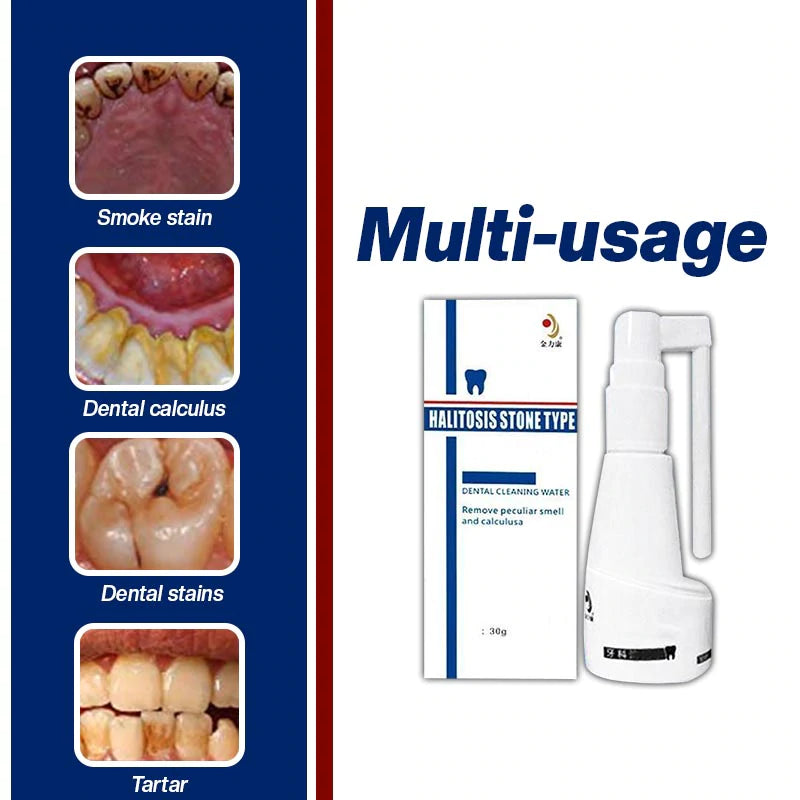 Calculus Free Dissolving Dental Spray【COD + Local Stock !】