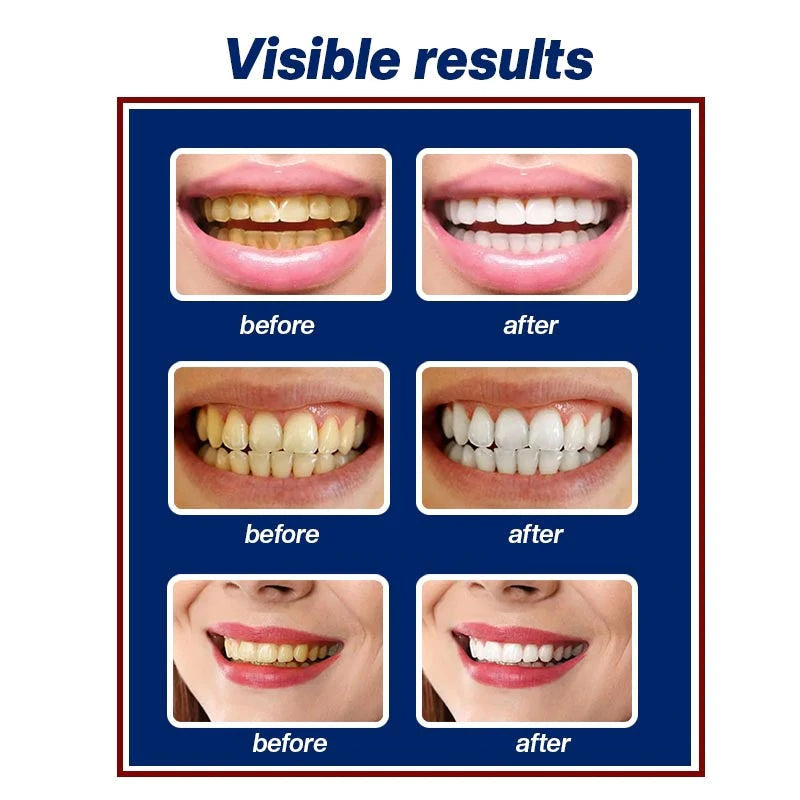 Calculus Free Dissolving Dental Spray【COD + Local Stock !】