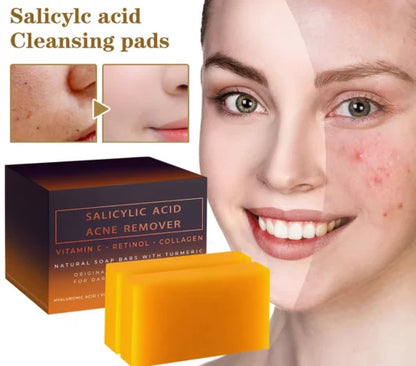 2025 NEW Warebrilla Acne Remover with Salicylic Acid