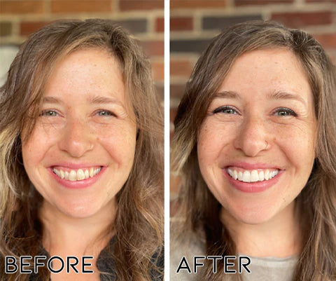 Oveallgo™ PRO Teeth Repair Stain Removal Ampoule