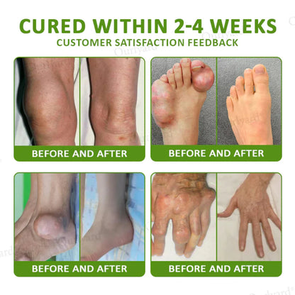 NovaRX® Magnesium & Peppermint Arthritis Pain Relief and Bone Healing Cream