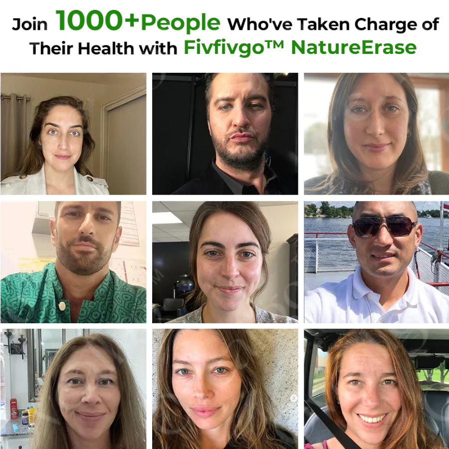 ✅ Official Store: Fivfivgo™ NatureErase Instant Mole & Spot Cream