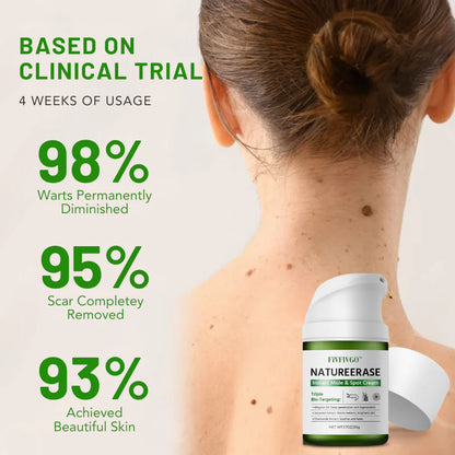 ✅ Official Store: Fivfivgo™ NatureErase Instant Mole & Spot Cream