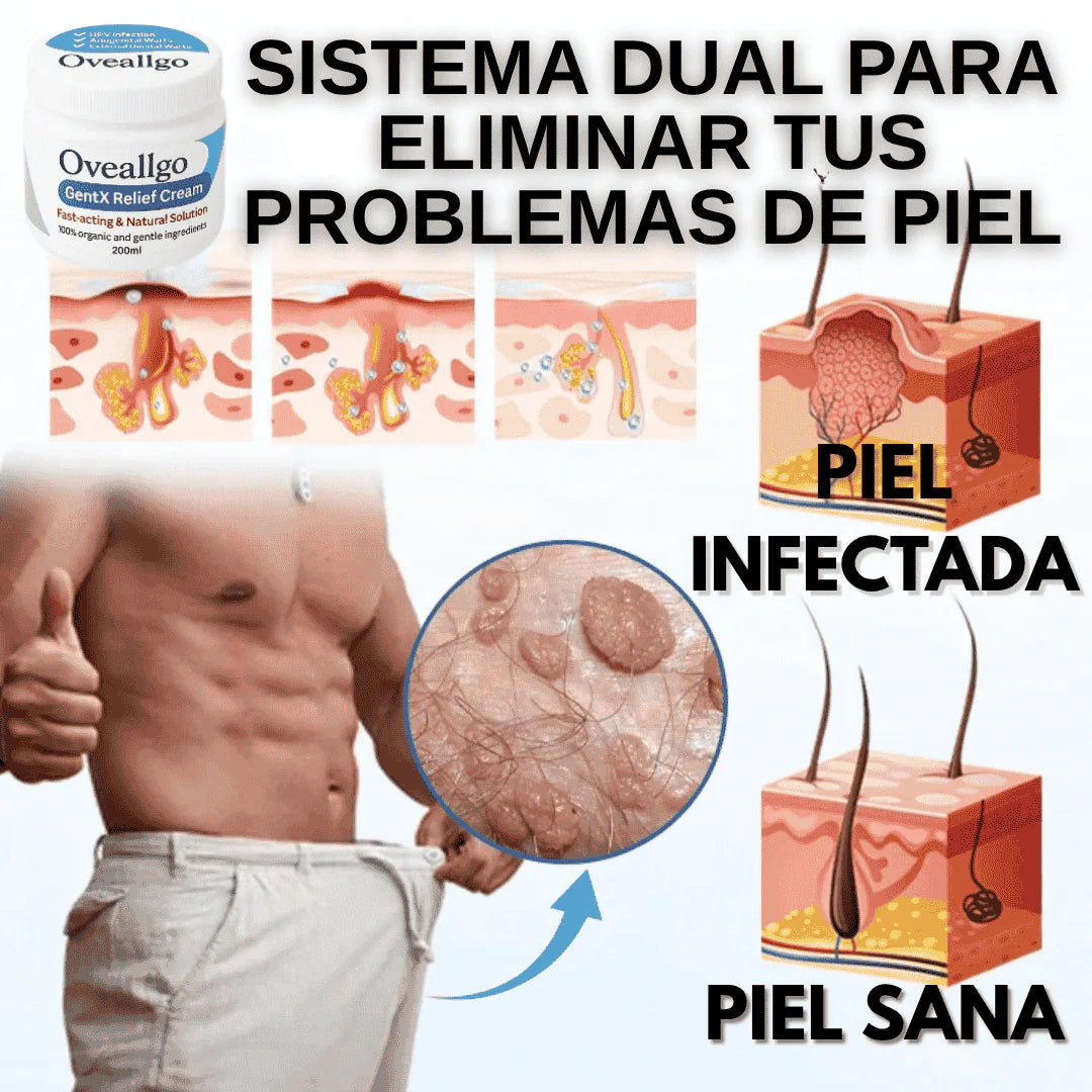 Oveallgo GentX® Eczema Cream.