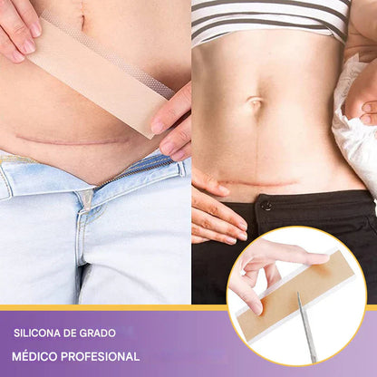 Oveallgo® Hyaluronic Acid Nano Microneedle Repair Tape