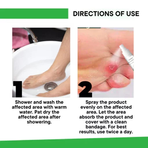 Pedimend™ corn removal spray