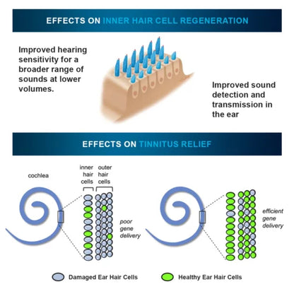 Remifa™ ProWave olovka za ublažavanje tinitusa