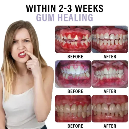 Oral care spray with clove oil