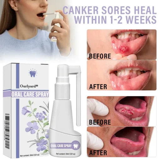 Oral care spray with clove oil